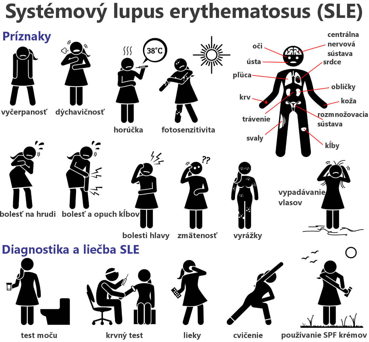 Syst Mov Lupus Erythematosus Sle O To Je Ak M Pr Znaky