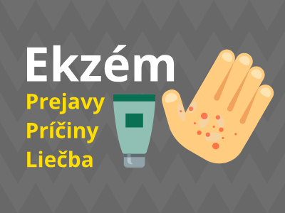 Ekzém - prejavy, príčiny, liečba Ekzém - prejavy, príčiny, liečba