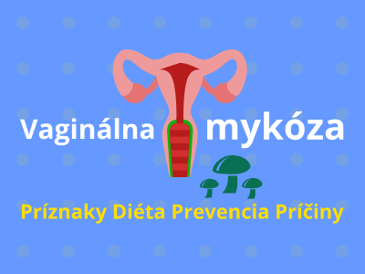 Vaginálna mykóza (príznaky, diéta, prevencia a príčiny) Vaginálna mykóza (príznaky, diéta, prevencia a príčiny)