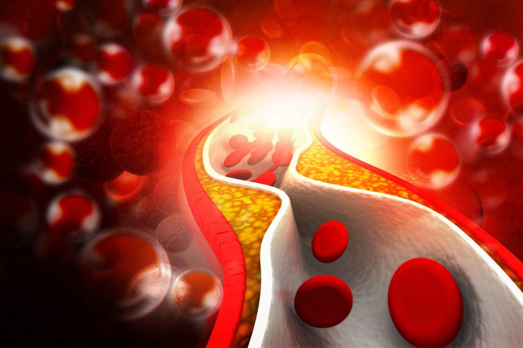 Cholesterol - hodnoty v krvi (jaká je norma LDL a HDL)