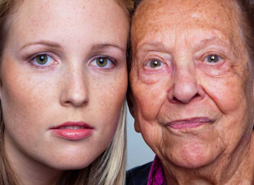 Pigmentové skvrny na obličeji u starých i mladých
