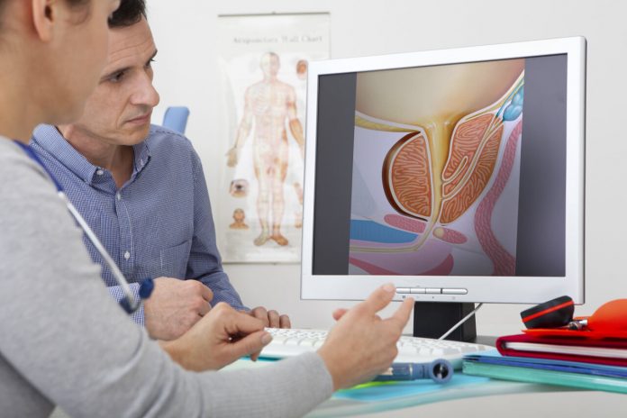 Zväčšená prostata, benígna hyperplázia prostaty Zväčšená prostata, benígna hyperplázia prostaty