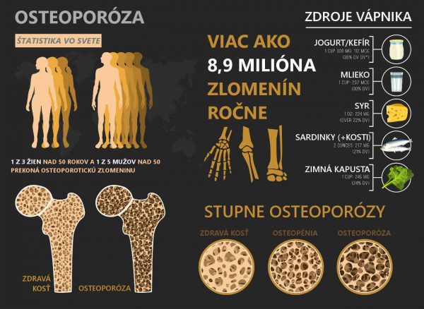 Osteoporóza Stupne Osteoporózy Liečba A Vhodná Strava Zdravovek 5617