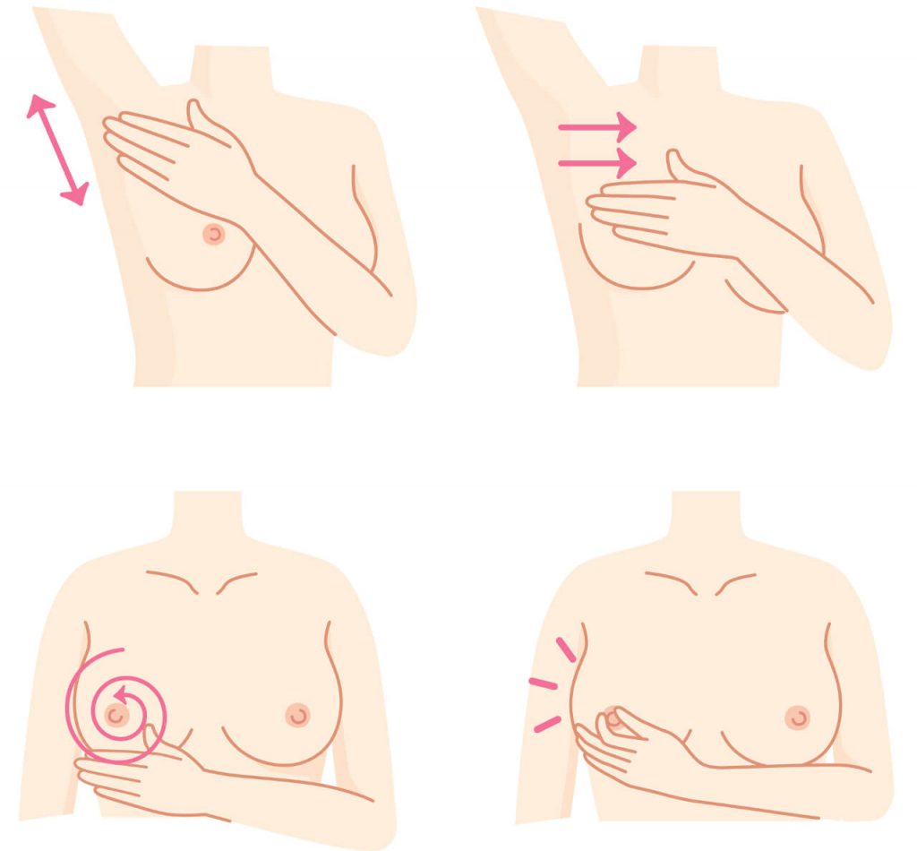 Bolesť prsníkov - môže to byť rakovina? Samovyšetrenie prsníka