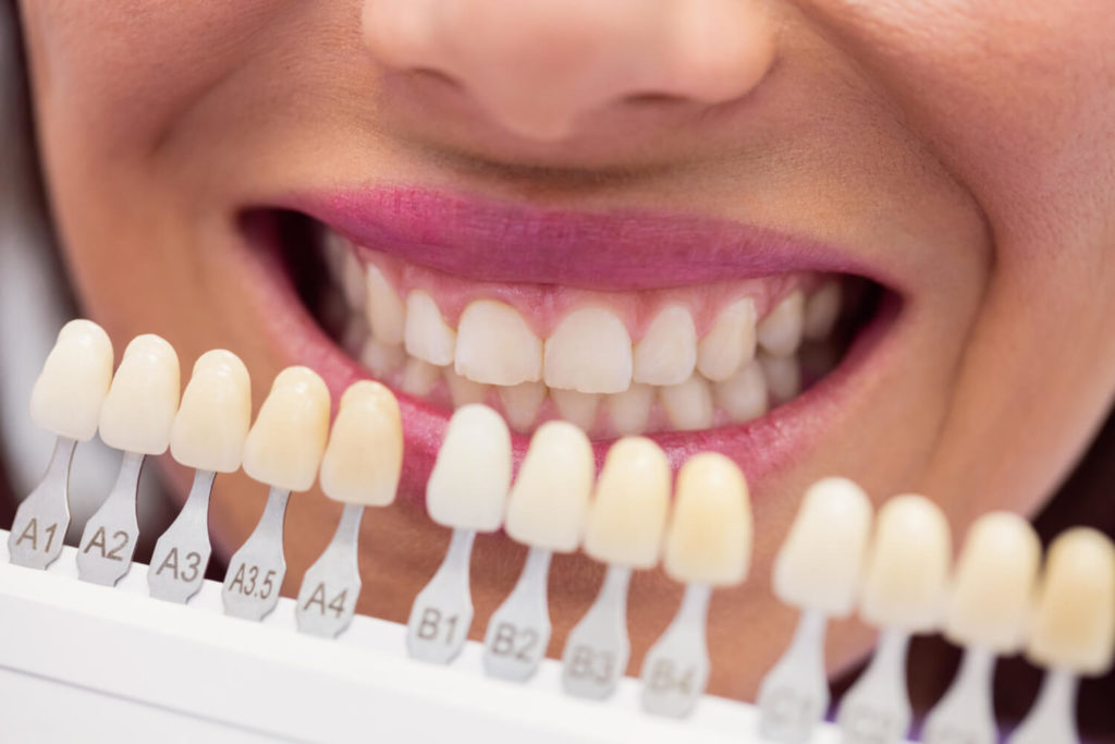 Dentálna hygiena: pre a proti