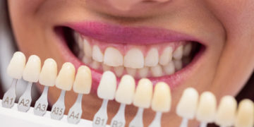Dentálna hygiena: pre a proti